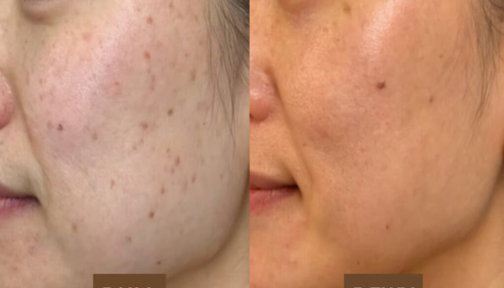 MOLD Manila Launches Radiance-Boosting Treatments to Transform Skin from Dull to Dewy (2)