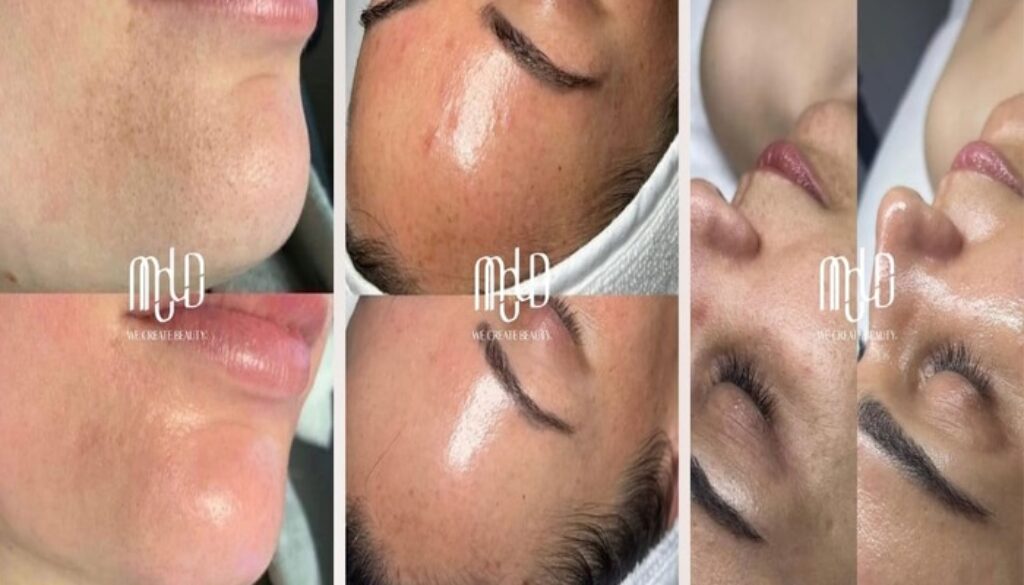 MOLD Manila Redefines Radiance with Science-Based Non-Surgical Aesthetic Care in Quezon City