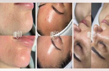 MOLD Manila Redefines Radiance with Science-Based Non-Surgical Aesthetic Care in Quezon City